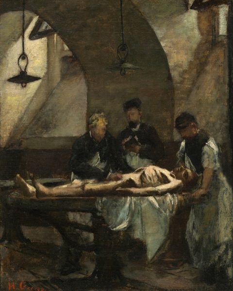 Three pale-skinned men wearing black garments and long, white aprons stand behind a table on which lies a nude corpse on a white sheet in this vertical painting. The corpse’s head is to our right and the face falls toward us. The eyes are sunken, and the rib cage and hip bones protrude sharply from the body. The men gathered behind the table are painted with fewer details so their faces are indistinct, though we can make out that the person to our left has gray hair, and he touches the corpse’s pelvis. The other two have dark beards and might wear black caps, and the middle person might take notes. The man to our right rests both hands on the table on either side of the corpse’s head and leans forward, looking down. The table is under the curve of a thick arched wall that separates two high, deep-set windows. Two unlit lamps hang above. The scene is painted with dabs and some visible brushstrokes, giving it a soft, shadowy, and hazy appearance. The artist signed the painting in red in the lower left, “H. Gervex.”